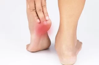 Ayurvedic Treatment For Heel Pain in Mumbai-Calcaneal Spur