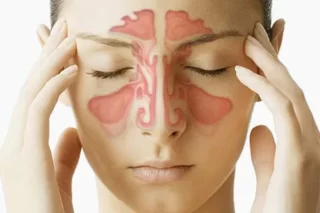 ayurvedic Sinusitis treatment clinic