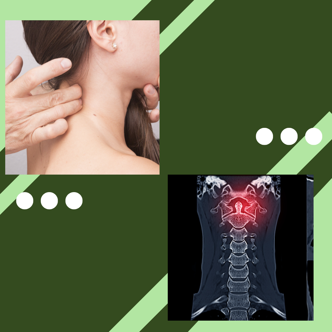 Ayurvedic Treatment for Cervical Spondylosis in Kurla, Mumbai